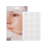 Onion Newpair Spot Patch Skin Fit 15patches